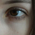 10 Cara Menghilangkan Mata Panda agar Wajah Terlihat Lebih Segar