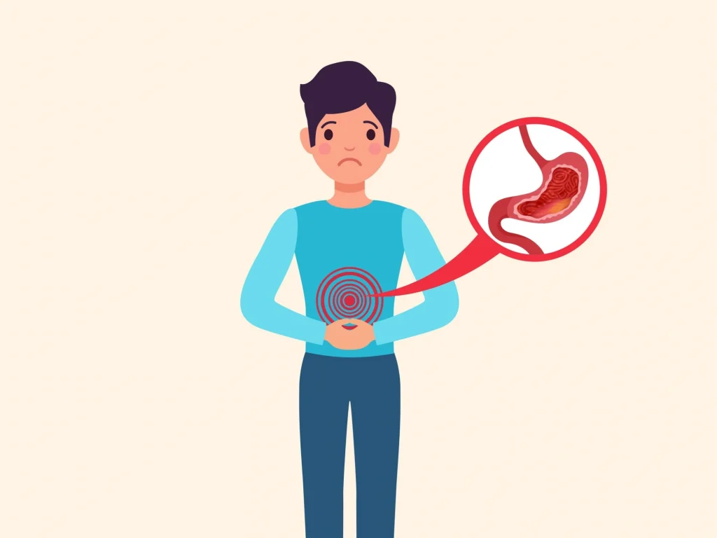 Cara Mengatasi Asam Lambung Naik, Atasi Heartburn dan Refluks